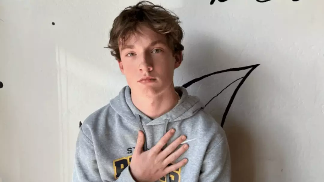 Streamers and gamers are noticing they have dents in their heads due to ...