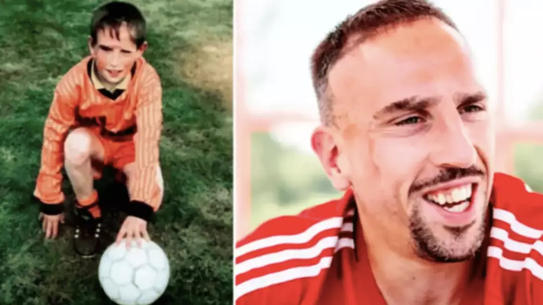 Frank Ribery Raded The heartbreaking story behind Franck Ribery's facial scars