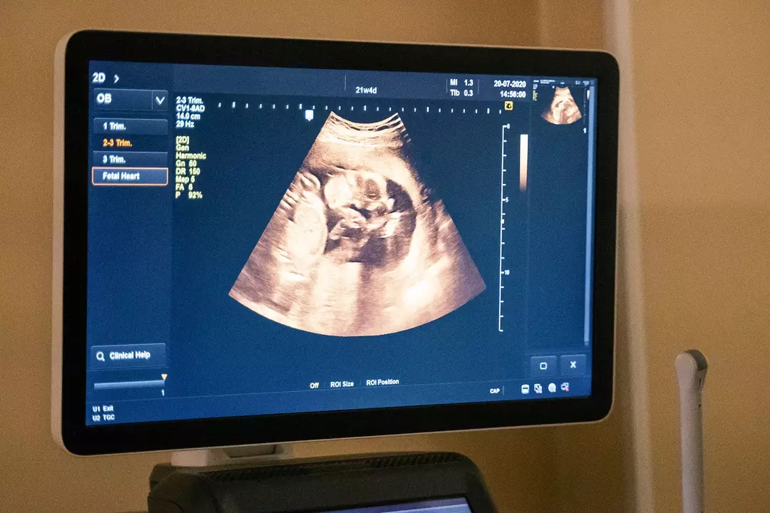 Woman gave birth inside MRI scanner to reveal the mechanics of ...