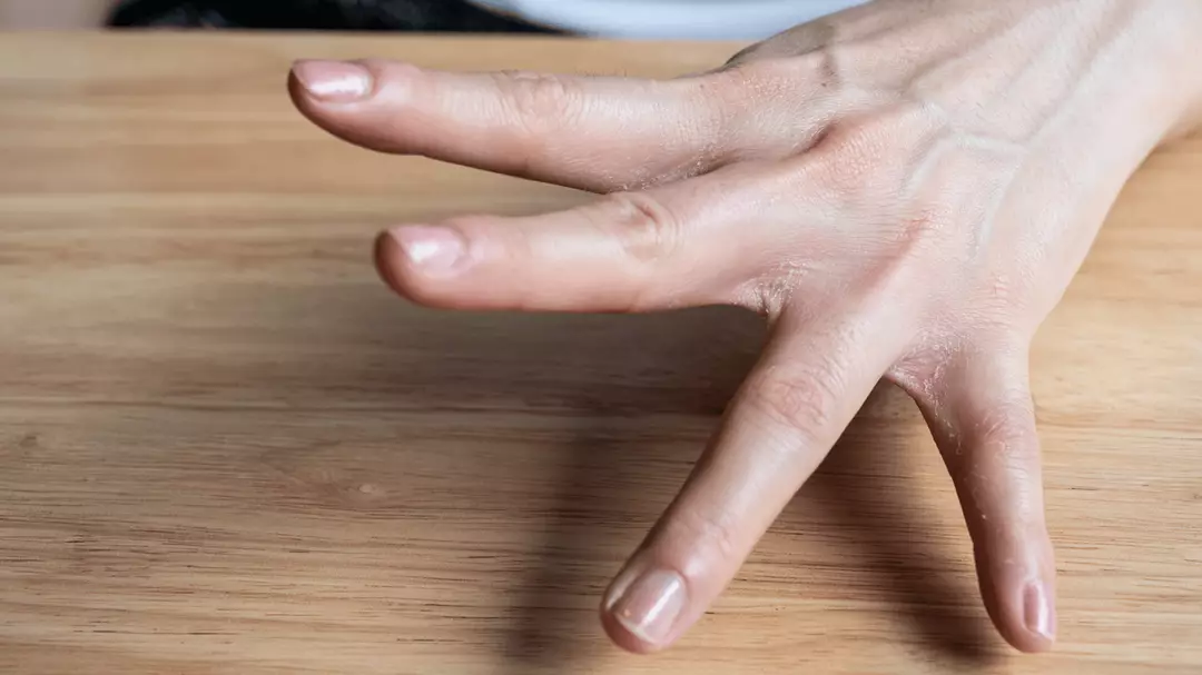 Finger 90 Split Being able to bend your fingers back a certain length could be a sign ...