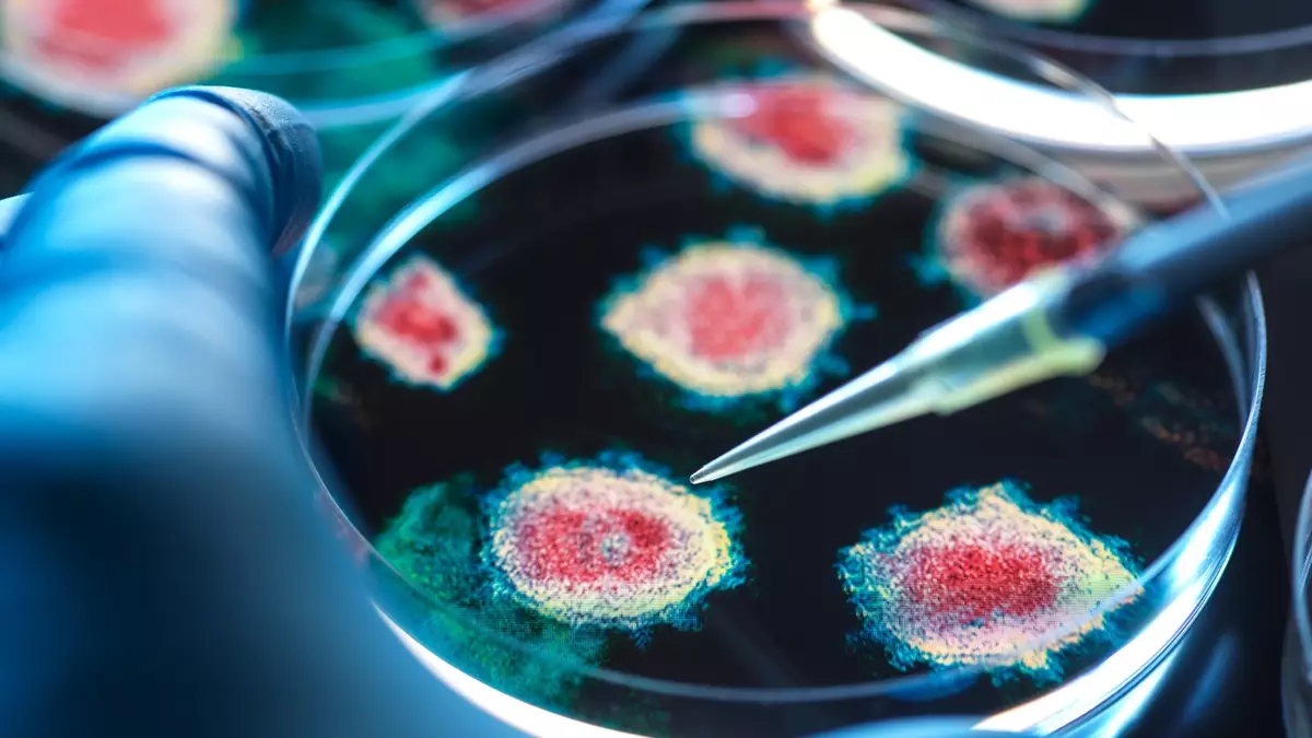 California resident tests positive for the plague as officials issue ...