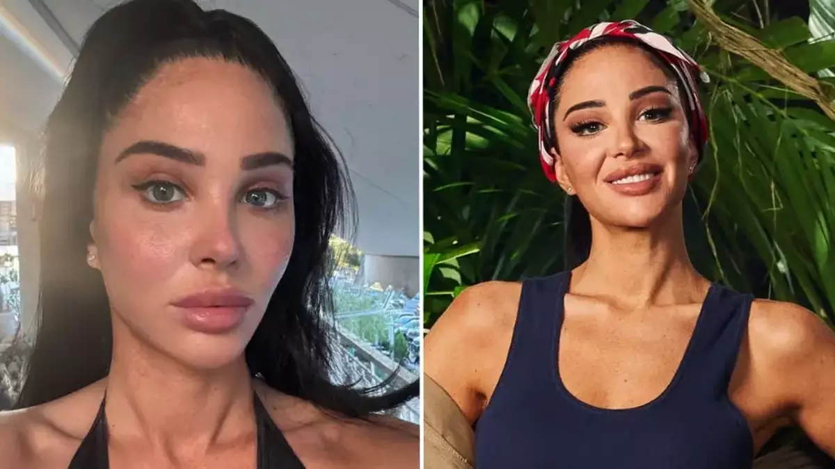 I’m A Celeb's Tulisa reveals heartbreaking reason behind cosmetic procedures she’s had done