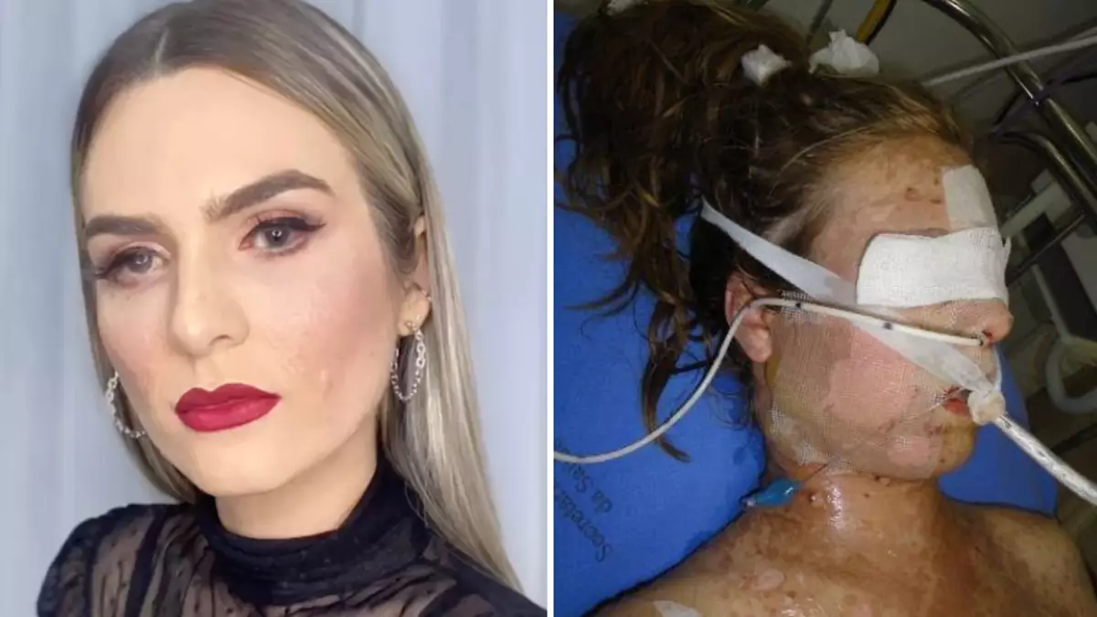 Woman left in 17-day coma ‘burning from the inside out’ after taking ibuprofen for period pain 