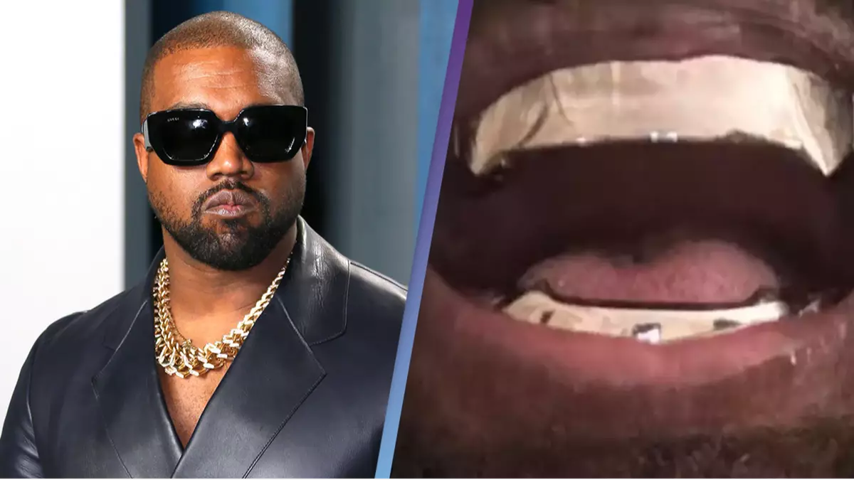 How Kanye West will clean his 850,000 titanium teeth