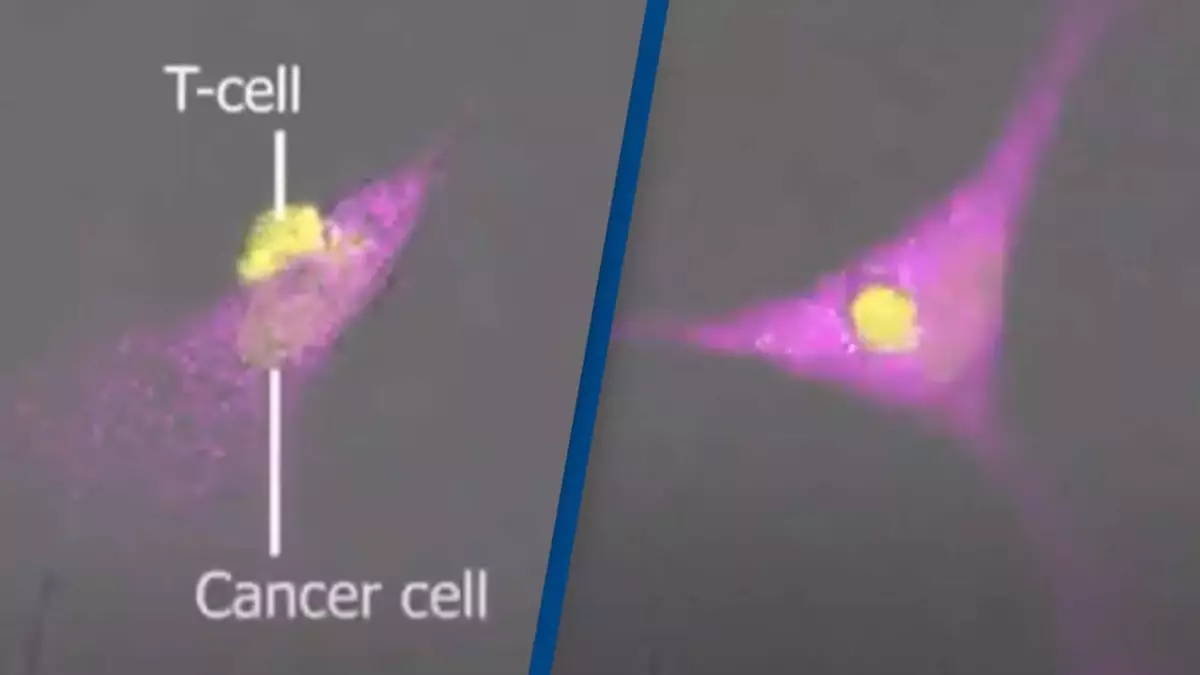 People amazed at 'wild' video of immune cell fighting a highly aggressive deadly cancer cell and winning