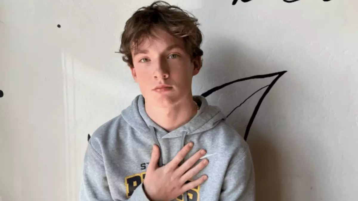 Streamers and gamers are noticing they have dents in their heads due to ...