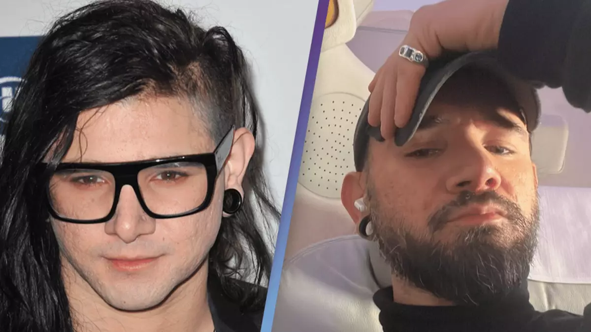 Skrillex Rapper Skrillex shows off dramatic new look and fans are stunned
