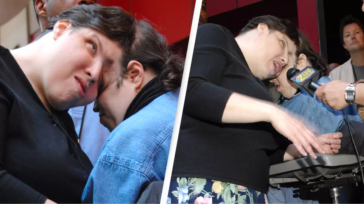 Conjoined twin who came out as trans 'kept desire hidden' from sister
