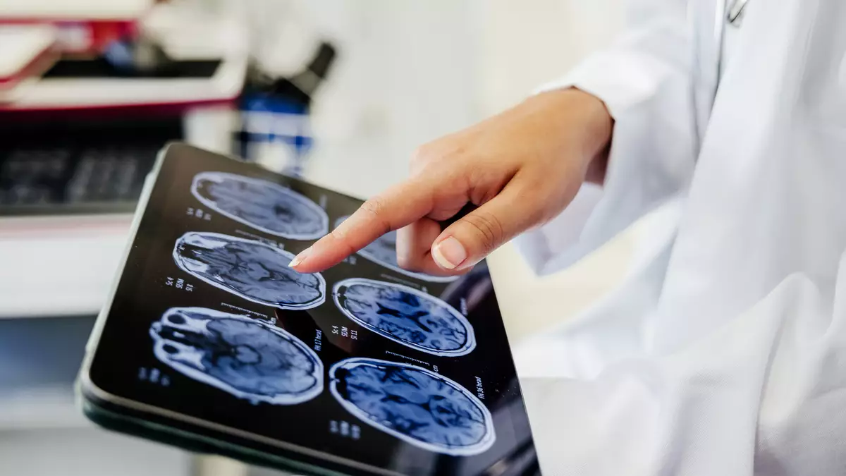 Scientists discover genetic reason why women's brains age differently to men's - News - UNILAD