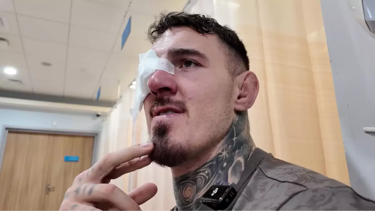 Tom Aspinall To Take Drastic Action If He Has Permanent Eye Damage After UFC 321