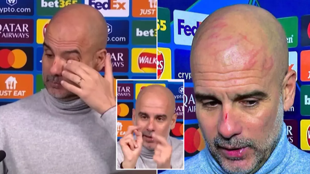 Pep Guardiola releases new statement explaining scratches on his face ...