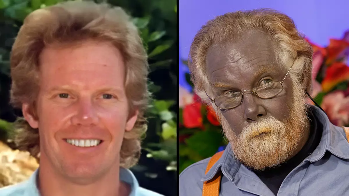 Strange case of Paul Karason who turned himself blue due to colloidal ...