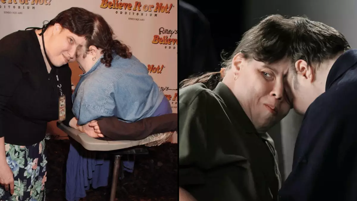 Conjoined Twin Explains How She Still Has Sex Despite Her Brother Being conjoined-twin-explains-how-she-still-has-sex-despite-her-brother-being