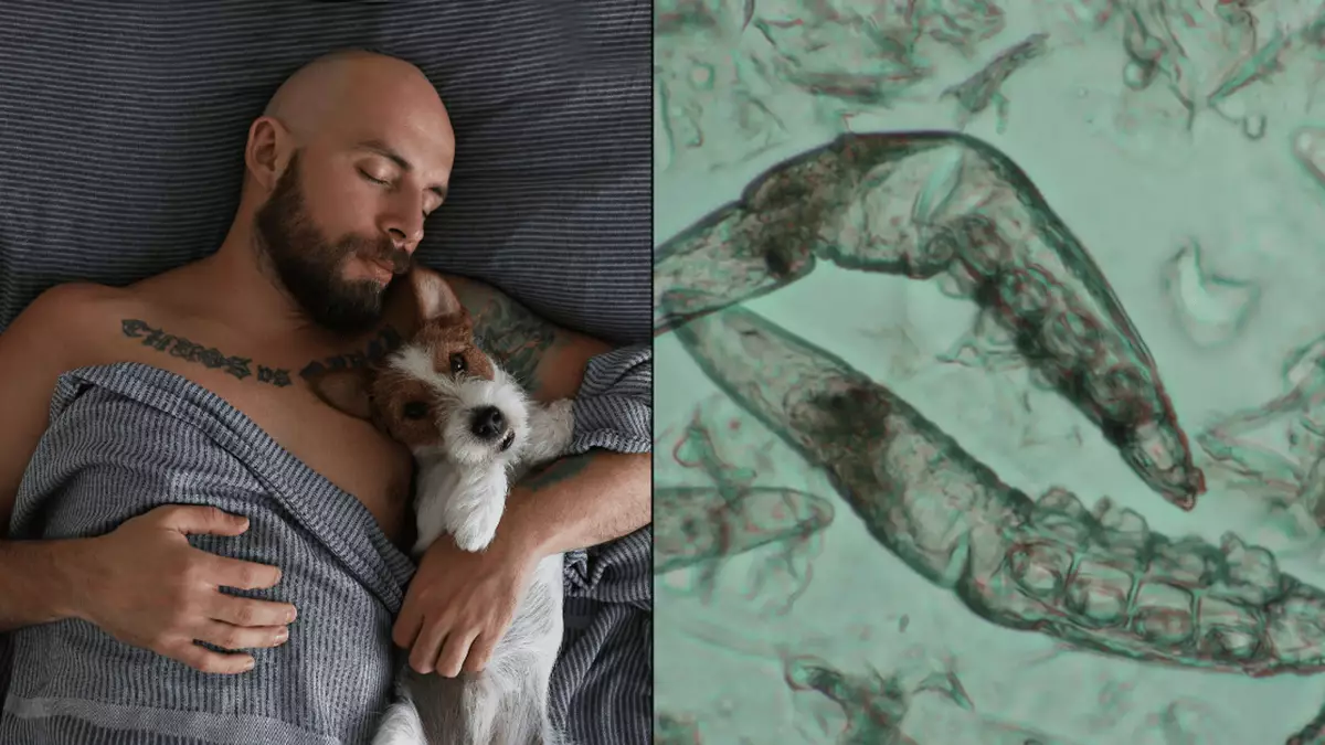 How to avoid parasitic eye infection caught by common bedroom habit that millions of people do – Health How to avoid parasitic eye infection caught by common bedroom habit that millions of people do – Health