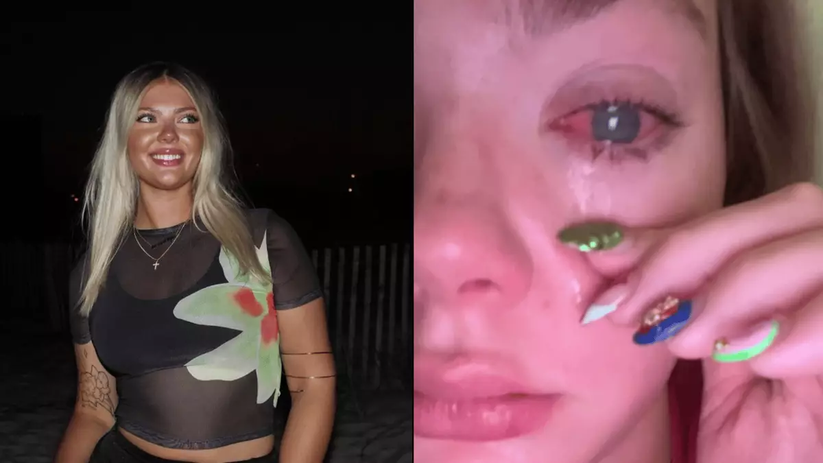 Woman who thought she had sand in her eye loses sight in it after making horrific discovery – Health Woman who thought she had sand in her eye loses sight in it after making horrific discovery – Health