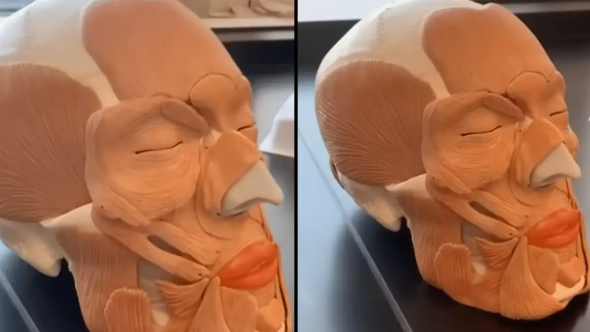 Dimples Features People are only just realising very common facial feature makes them ...