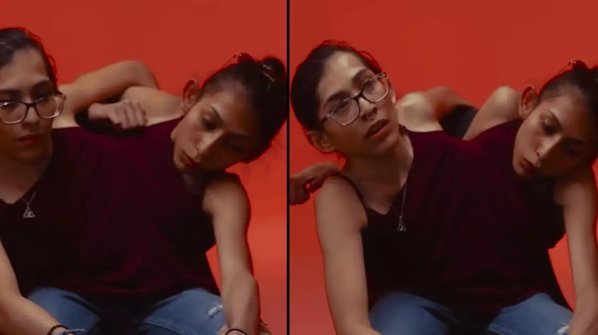 3 Conjoined Conjoined twins reveal devastating thing which would happen if they ...
