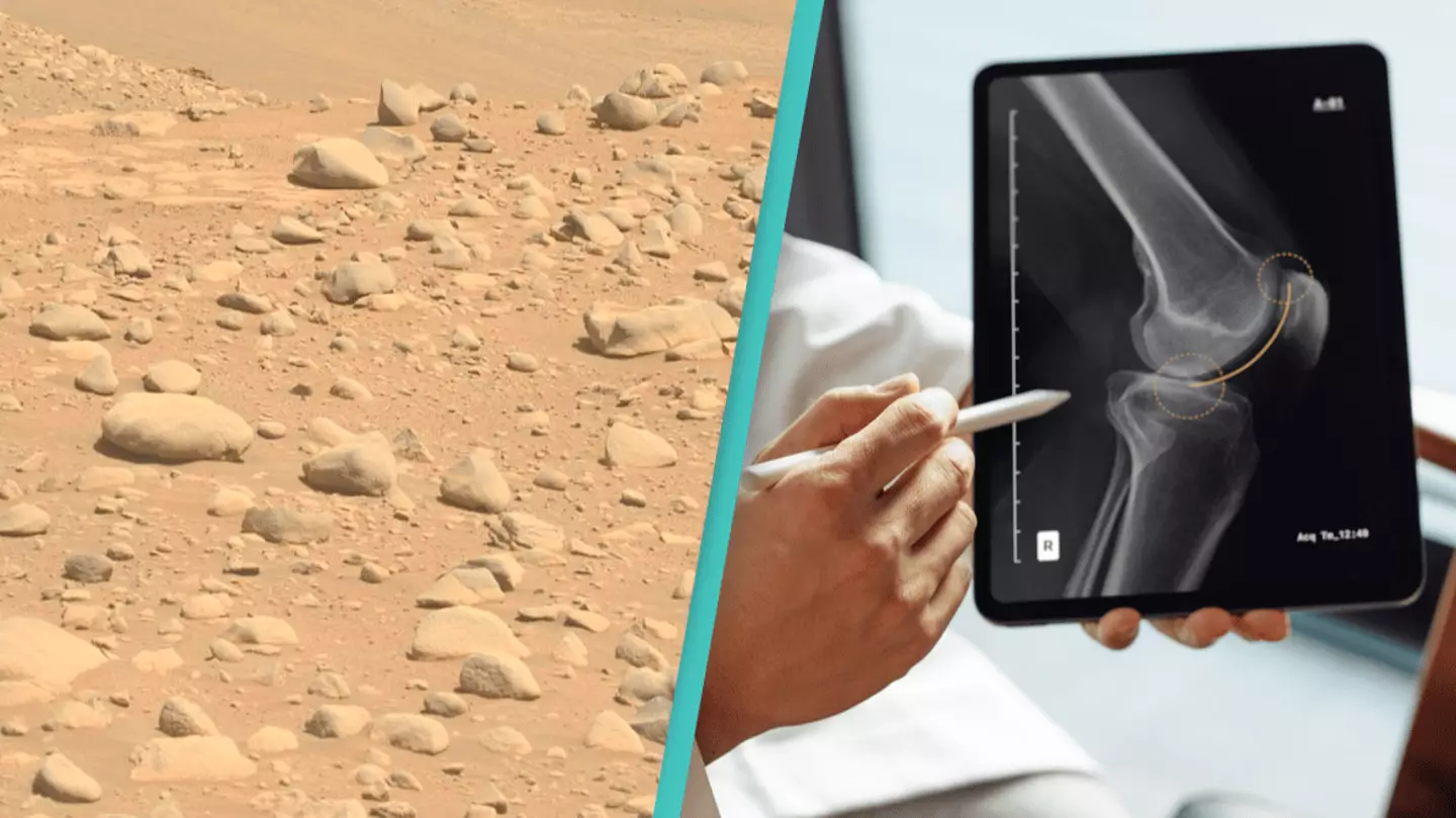 Mars Body Types Scientist explains the weird stuff that would happen to the first ...