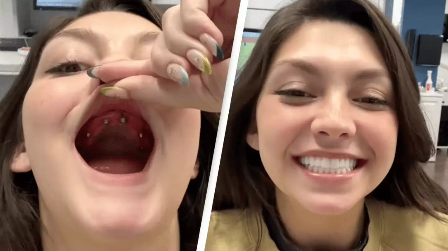 Woman shows incredible process of getting 'new teeth' that's leaving ...