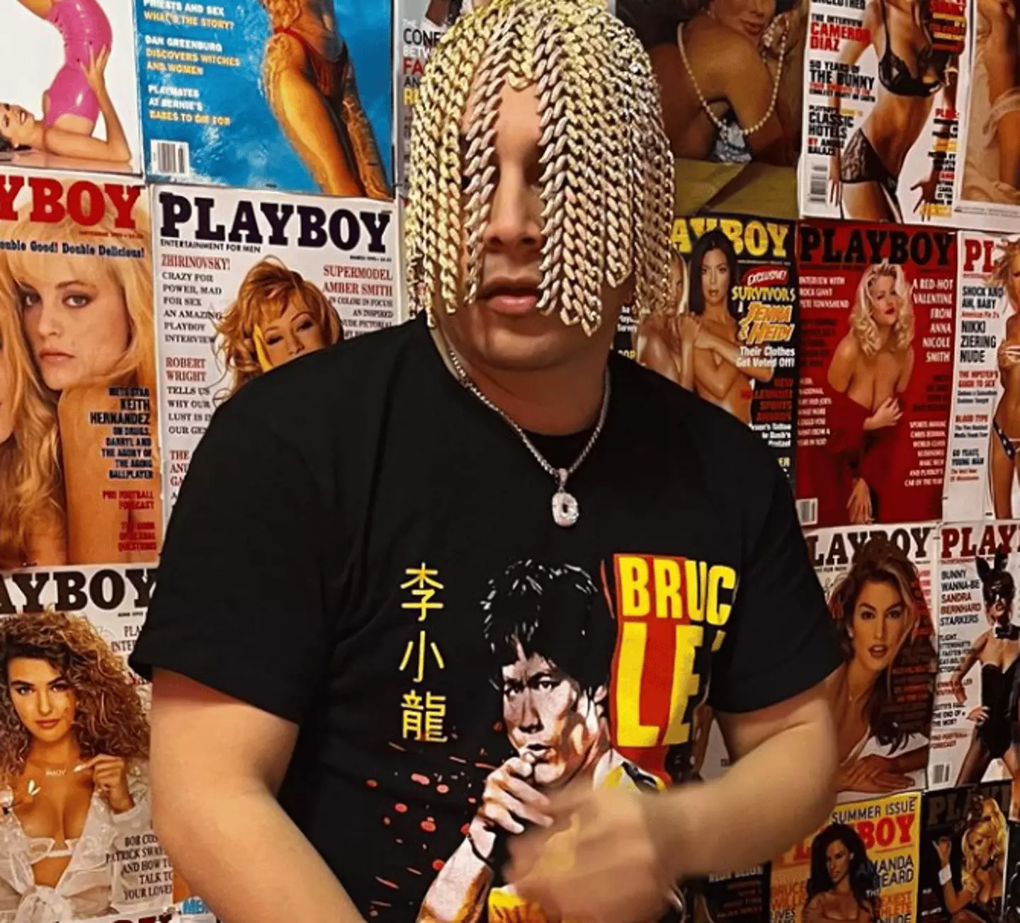 Thread Rapper Rapper faces serious risks after having gold chains surgically ...