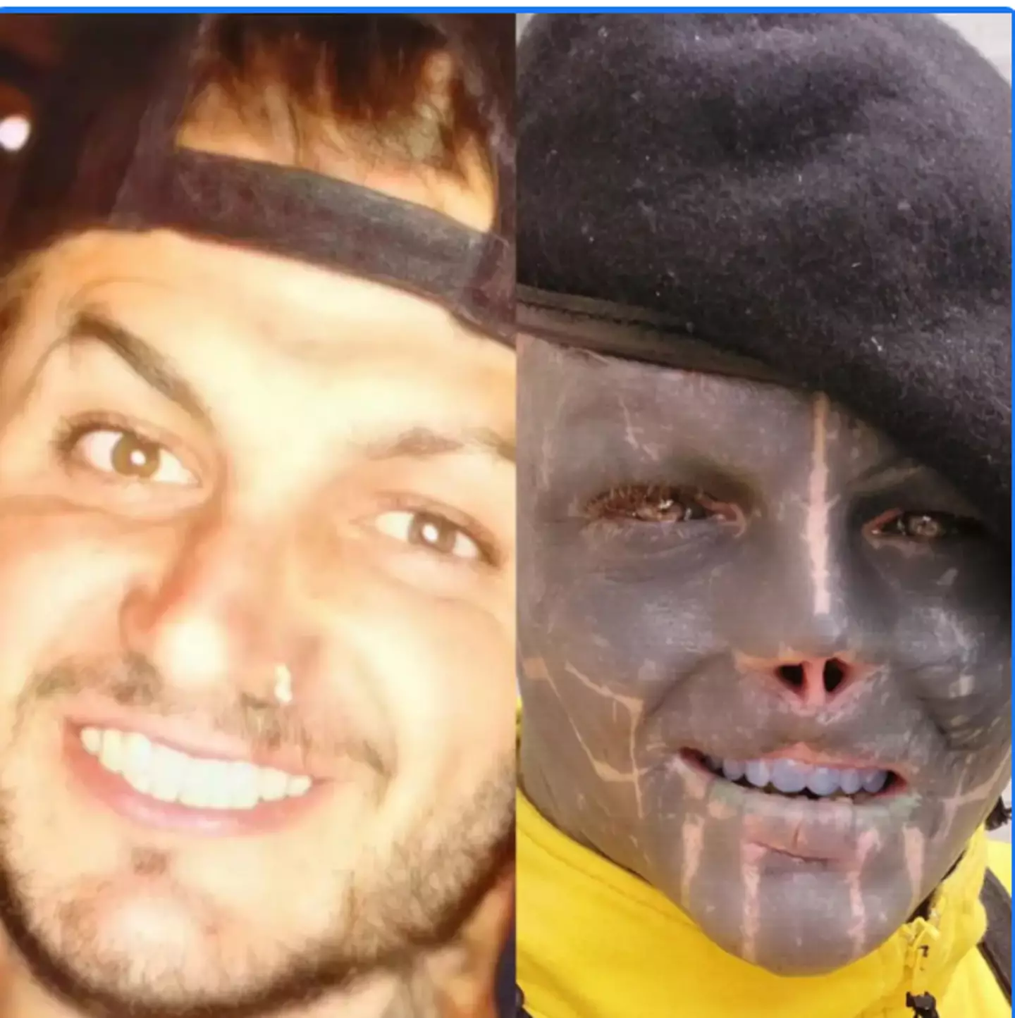 'Black alien' with extreme body modifications shares image of what he ...