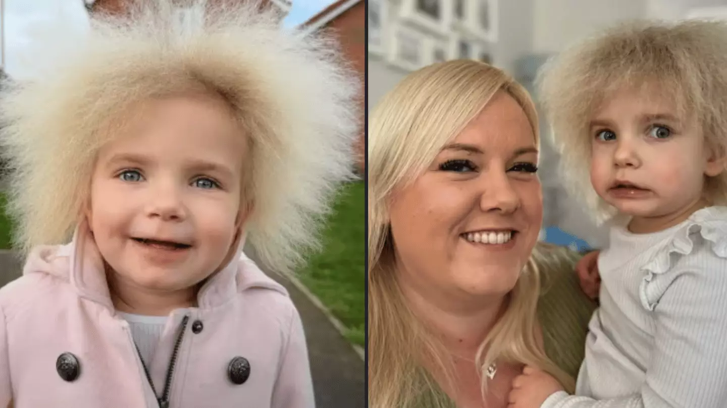 Layla Davis British girl with rare uncombable hair syndrome is one of only 100 in world