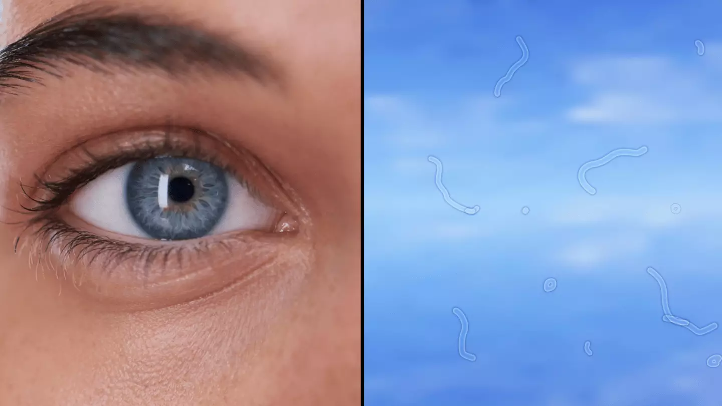 Expert explains what you should do if you start seeing these 'floaters ...