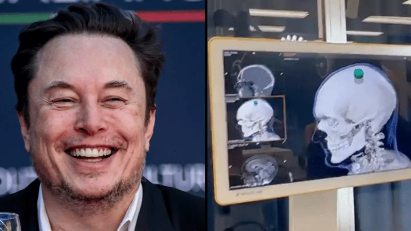Elon Musk announces first Neuralink brain chip has been implanted in a ...