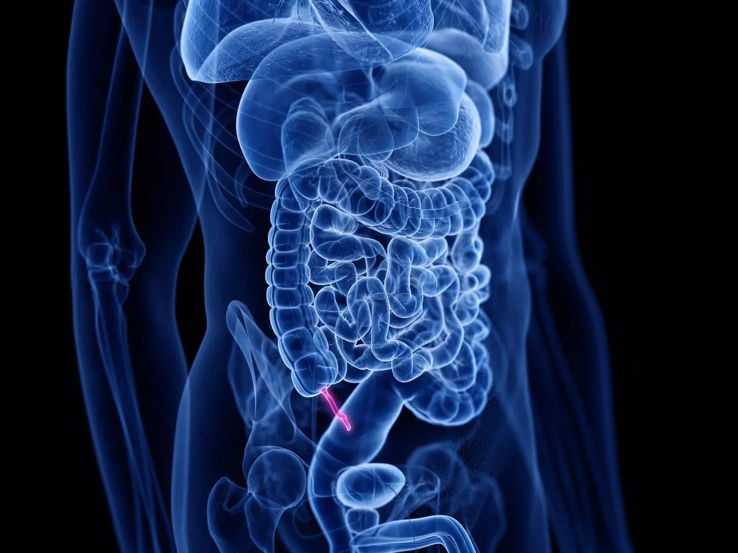 Eight subtle symptoms that could mean you have rare appendix cancer as ...