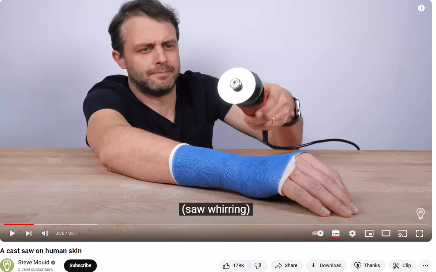 Incredible reason why a cast saw won't cut through human skin