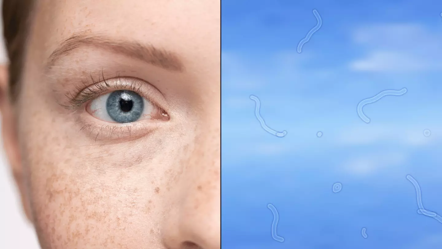 Floating Eye Mini Reason why you get 'floaters' in your eyes as expert explains what you ...
