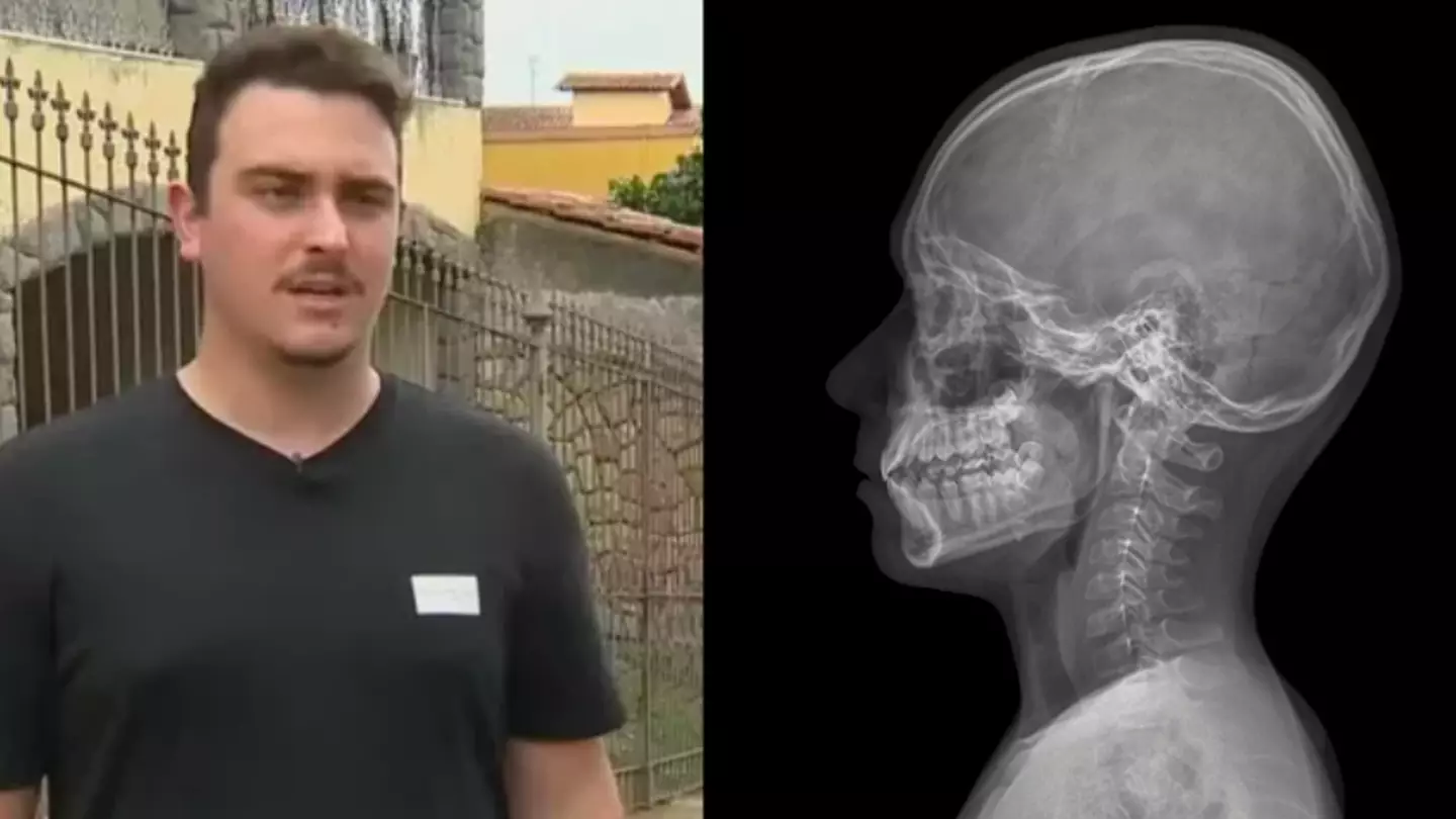 Bloke parties for four days after being shot in the head - News - LADbible