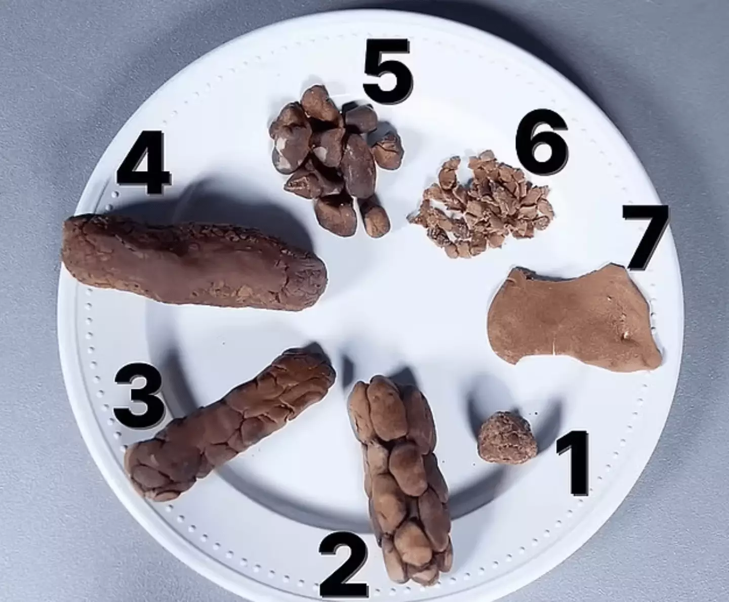 Doctor warns when to seek immediate medical help because of your poo