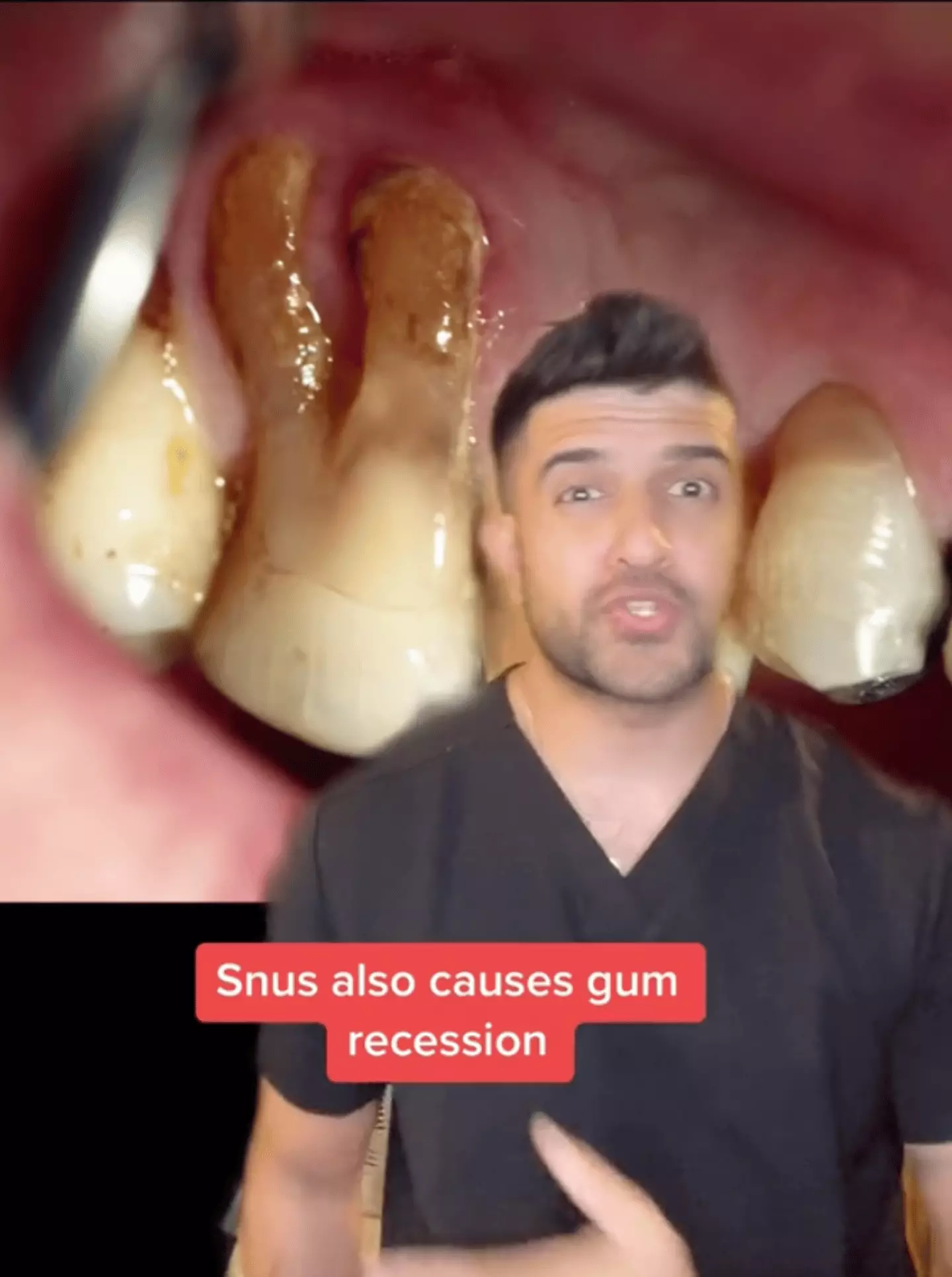 Last Snus Timeline of everything that happens to your body when you quit taking snus