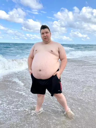 YouTuber Nikocado Avocado shares shocking results of plastic surgery ...