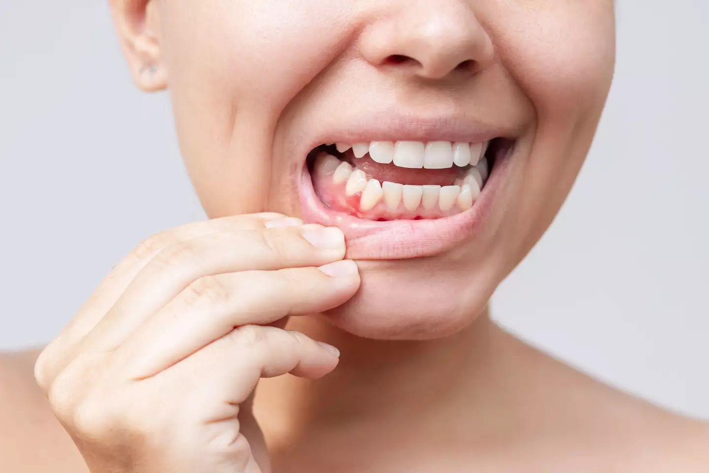 Inflamed gums ought to be checked out by a professional (Marina Demeshko/Getty Images)