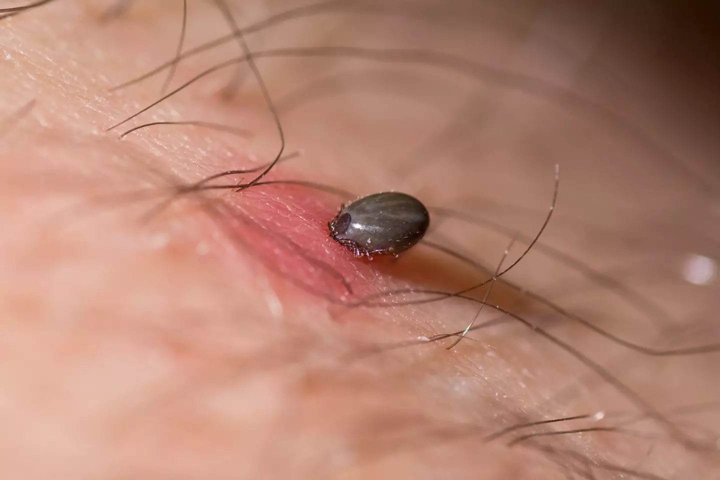 Ticks swell up as they feast on your blood (Ian_Redding/Getty Images)