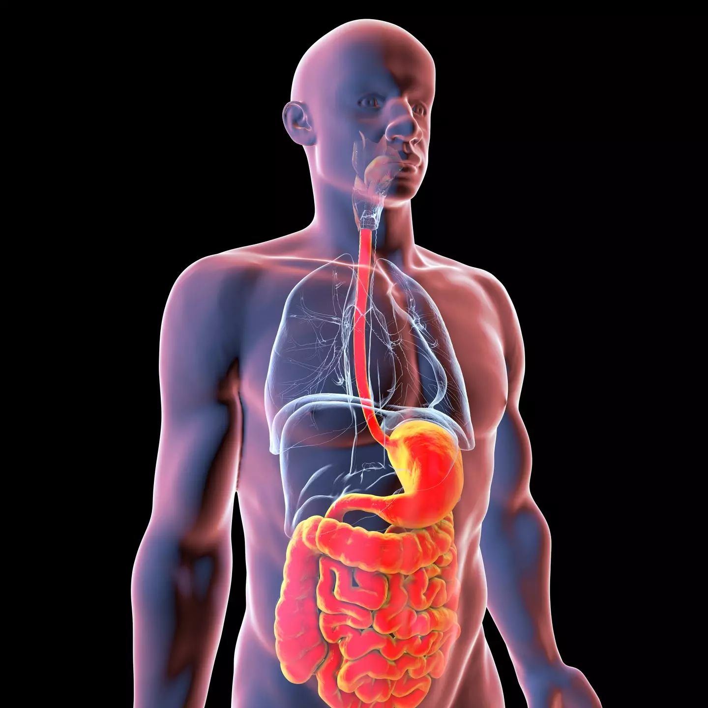 A nutrition expert has explained how a prevalent gut issue may increase cancer risk (KATERYNA KON/SCIENCE PHOTO LIBRARY/Getty Images)