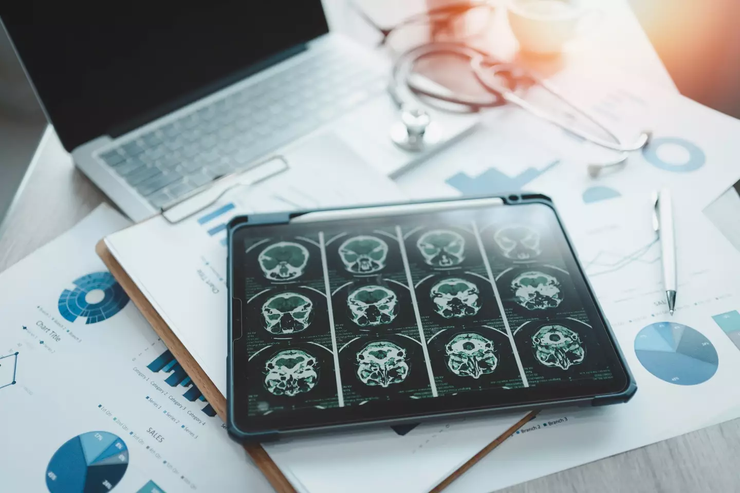 The risk of developing dementia begins to increase dramatically once people are over 65 years old (Teera Konakan/Getty Images)