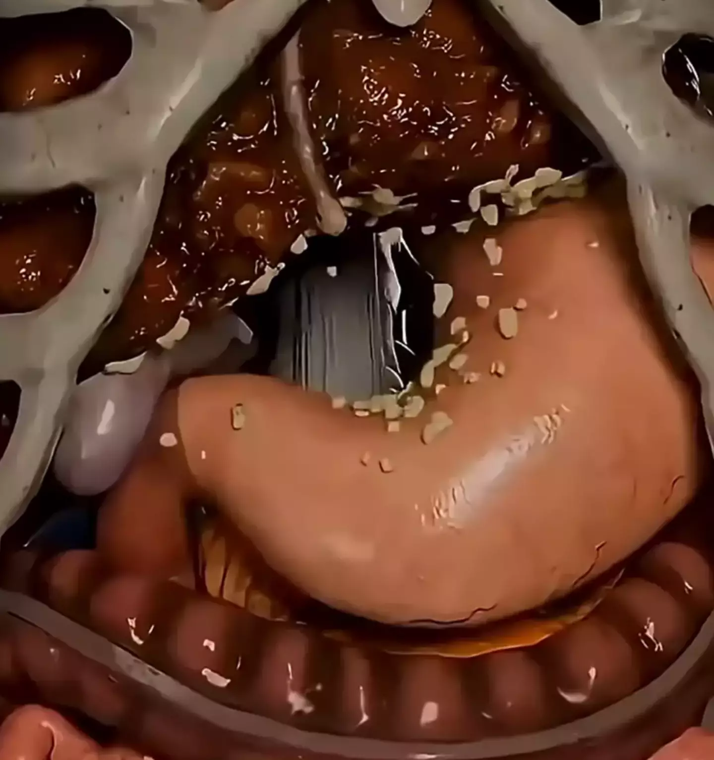 A simulation has now shown how the body reacts after no food for 72 hours. (YouTube/MedBright)