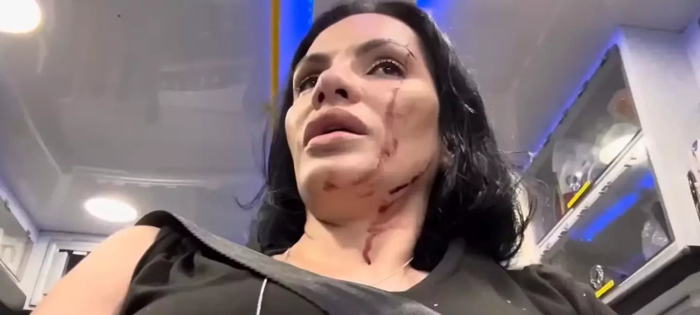 Santiago shared images of her injuries after the incident (KPRC 2 Click2Houston)