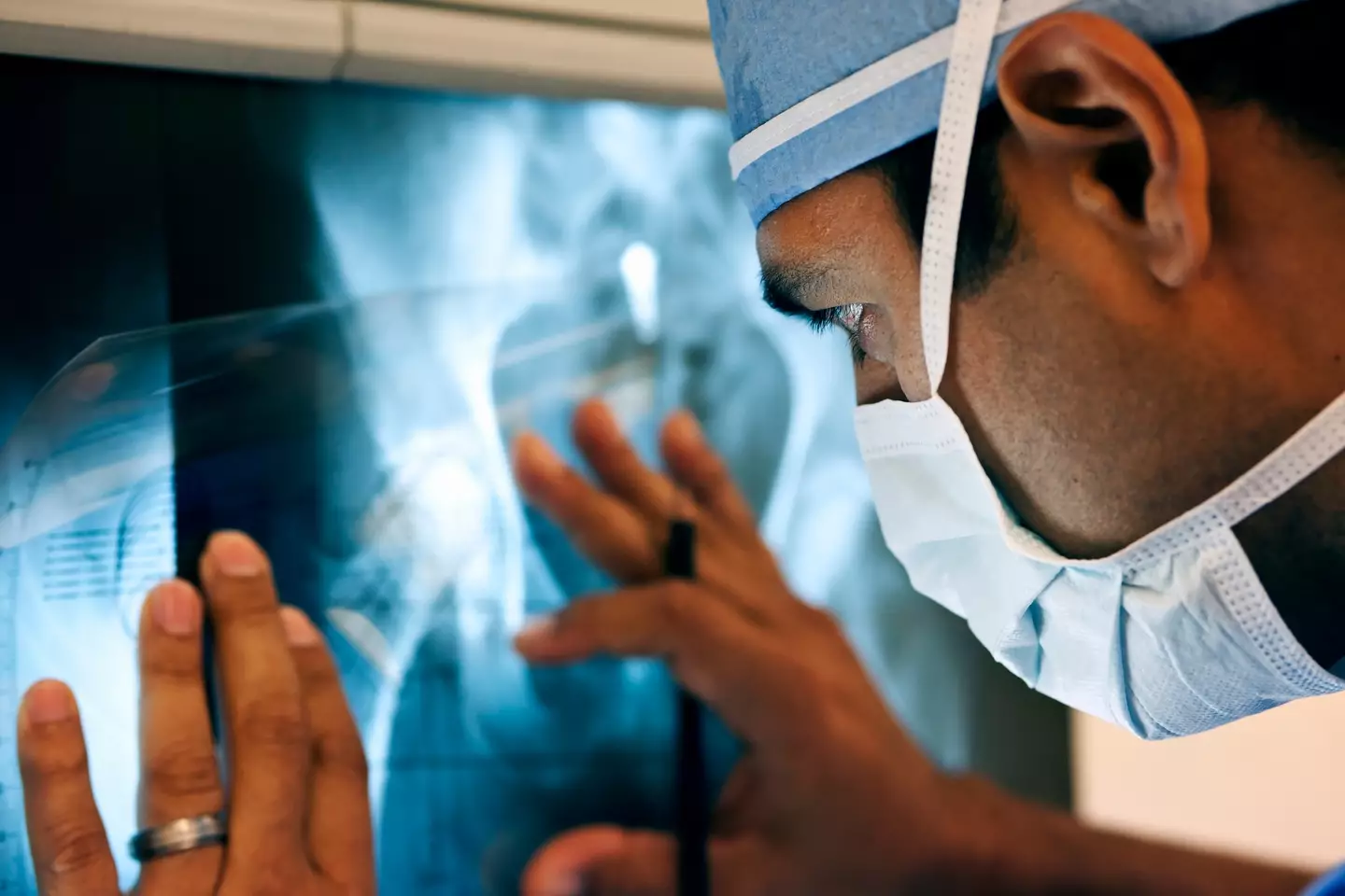 Dietary deficiencies can contribute to developing osteoporosis (Dana Neely/Getty Images)