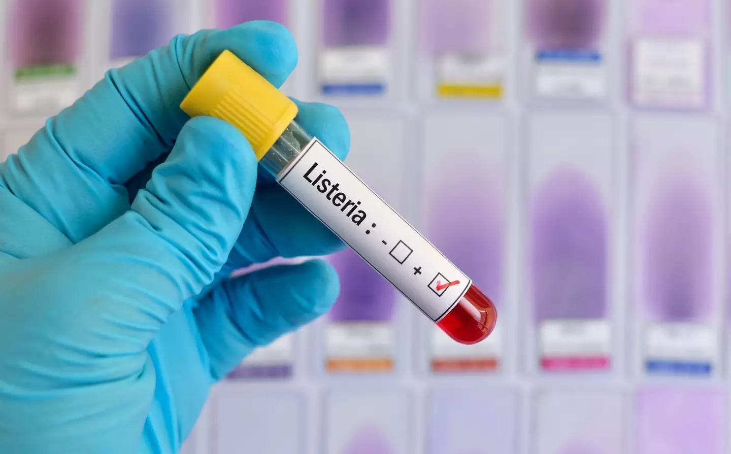 Listeria infection can be very nasty indeed (jarun011/Getty Images)