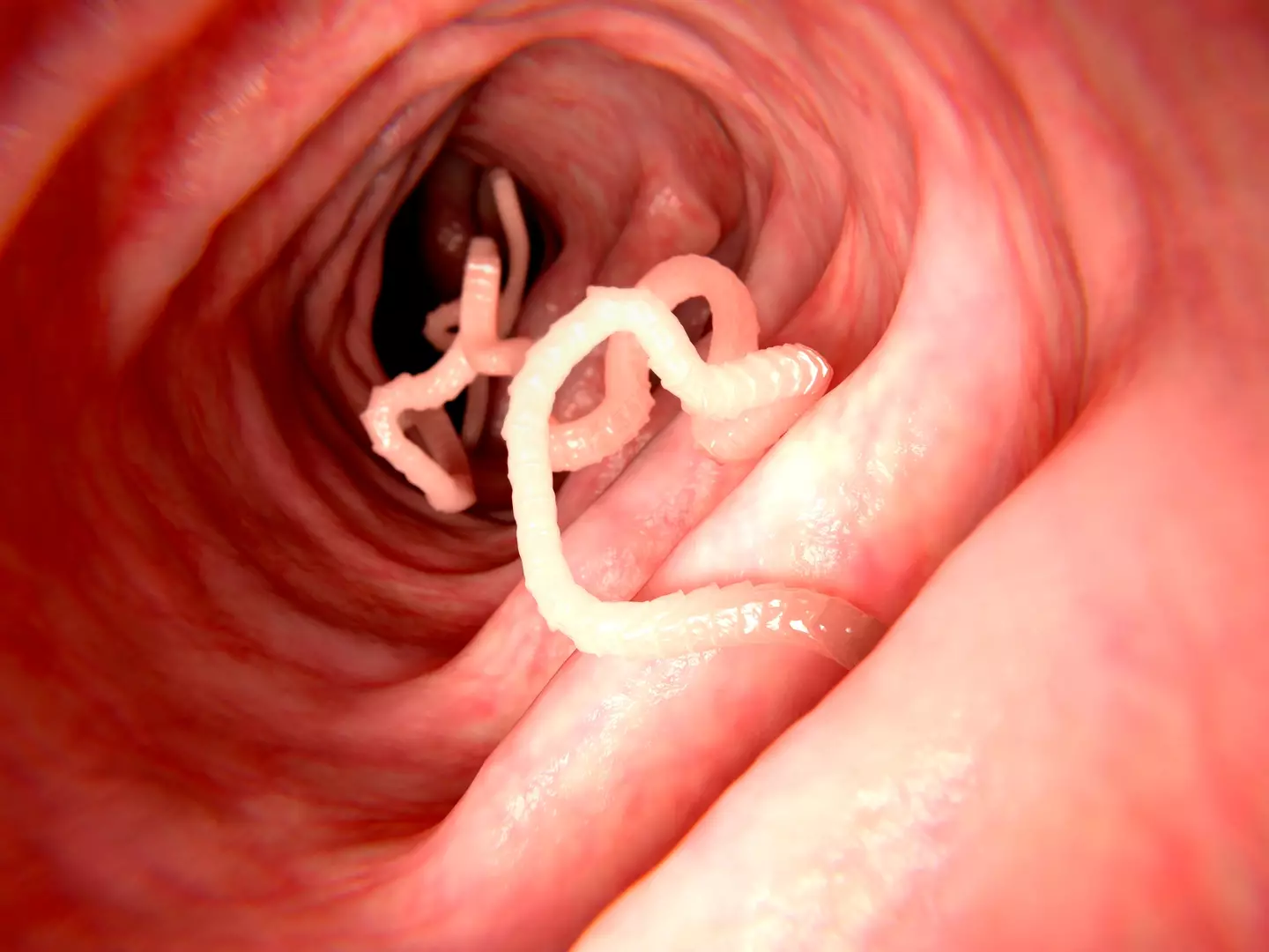 Allergies are thought to be the result of underused worm-fighting immune capabilities (JUAN GAERTNER/SCIENCE PHOTO LIBRARY/Getty Images)