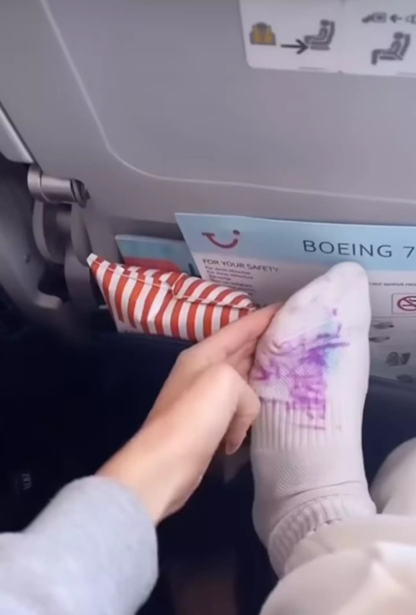 The woman was shocked when the child drew on her sock.