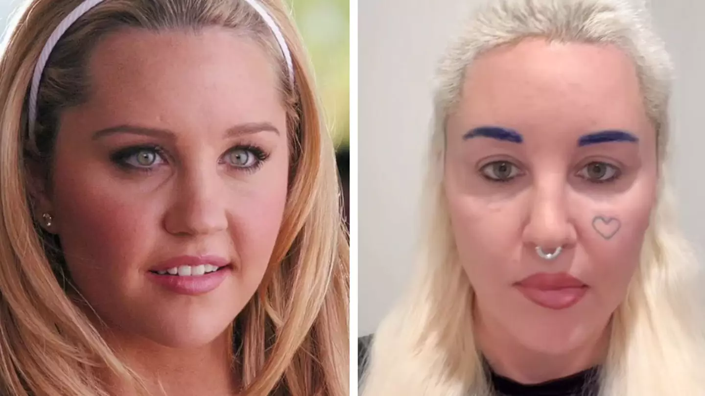 Amanda Bynes says having bleph surgery was 'one of the greatest things she ever did'
