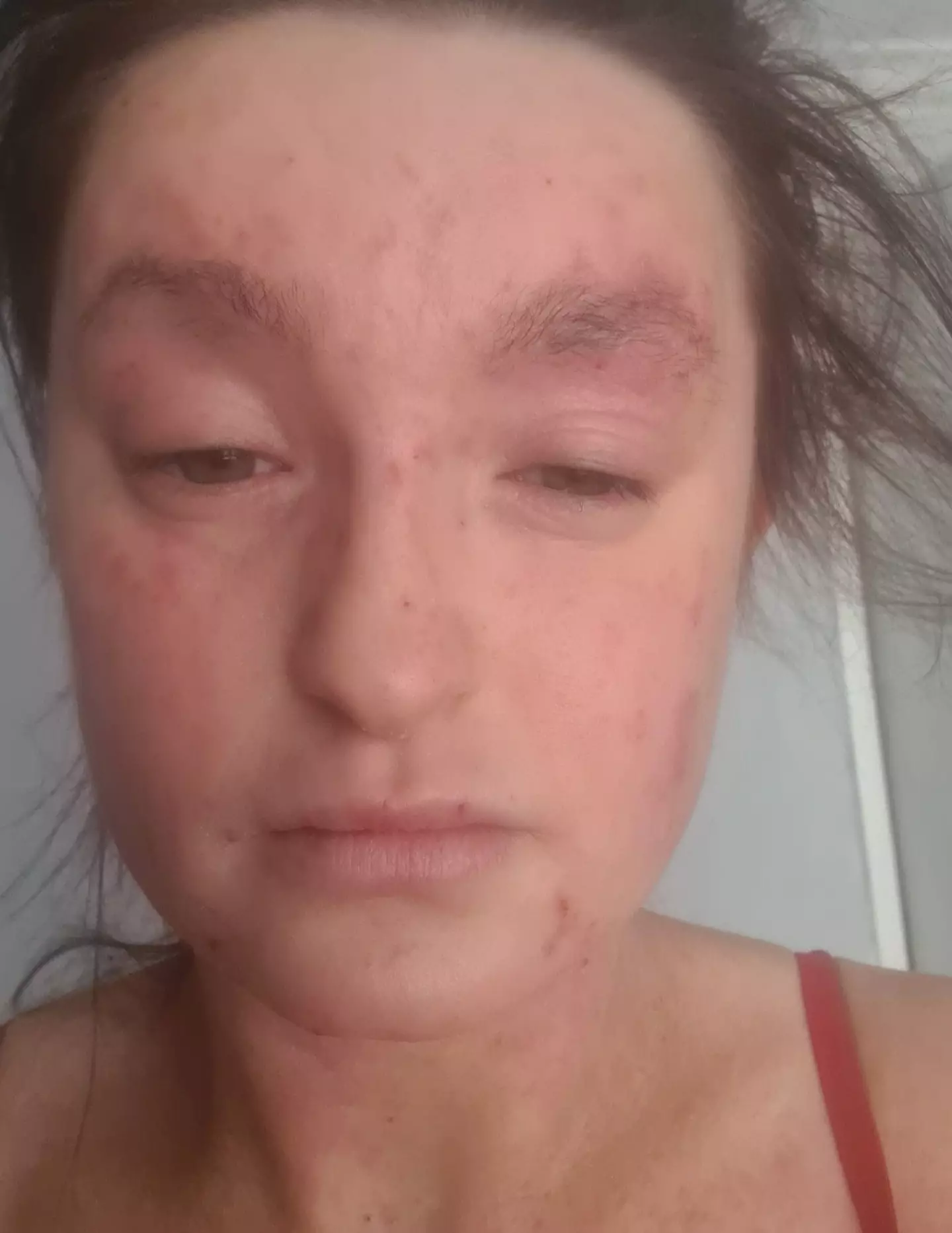 Antonia's life was changed by a new drug.