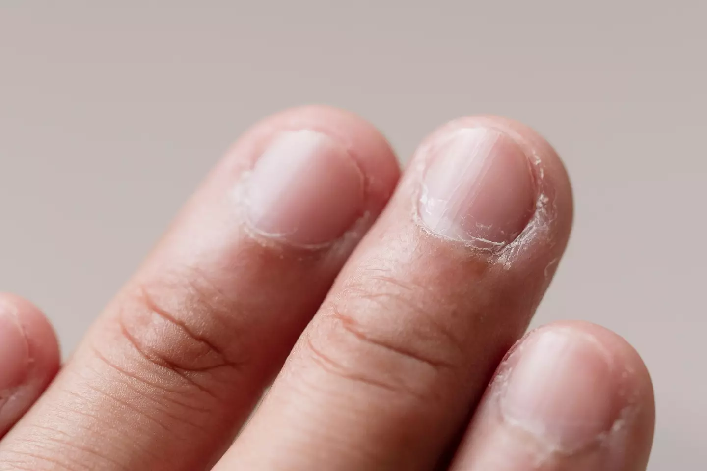 The common habit might not be as harmless as you think (Getty Stock Images)