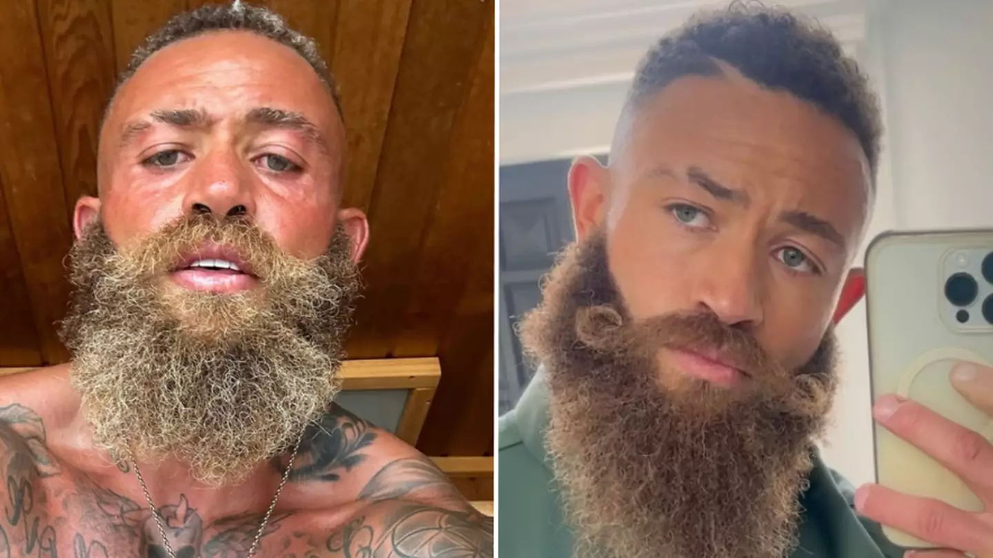 Ashley Cain has incredible revelation about his beard after admitting heartbreaking reason why he’d never shave it