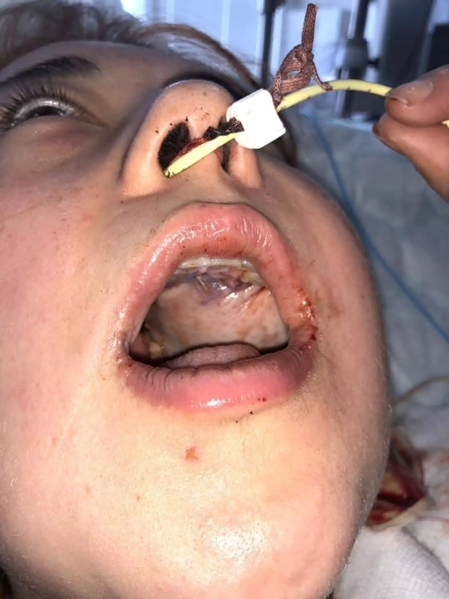 Jordan suffered with a toothache and bleeding gums